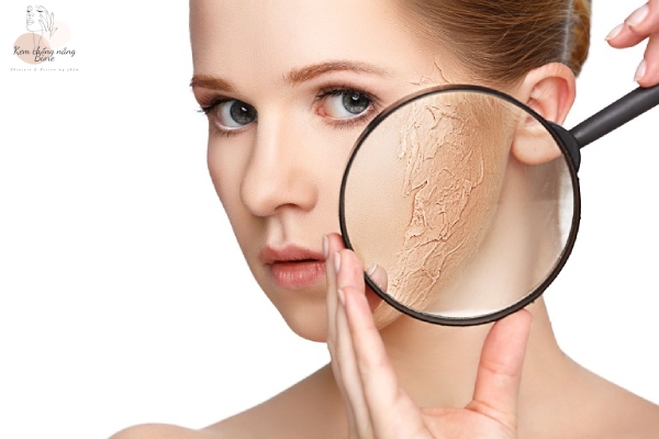 Đặc điểm của làn da này là có bề mặt da hơi căng rát và cảm giác như bị thiếu nước