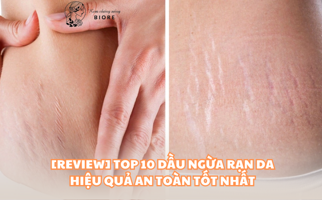 [REVIEW] TOP 10 DẦU NGỪA RẠN DA HIỆU QUẢ AN TOÀN TỐT NHẤT