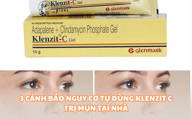 3 Cảnh báo nguy cơ tự dùng Klenzit C trị mụn tại nhà