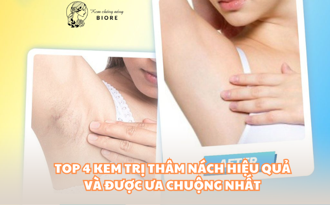 Top 4 Kem Trị Thâm Nách Hiệu Quả Cao Giúp Trắng Mịn, Giảm Thâm